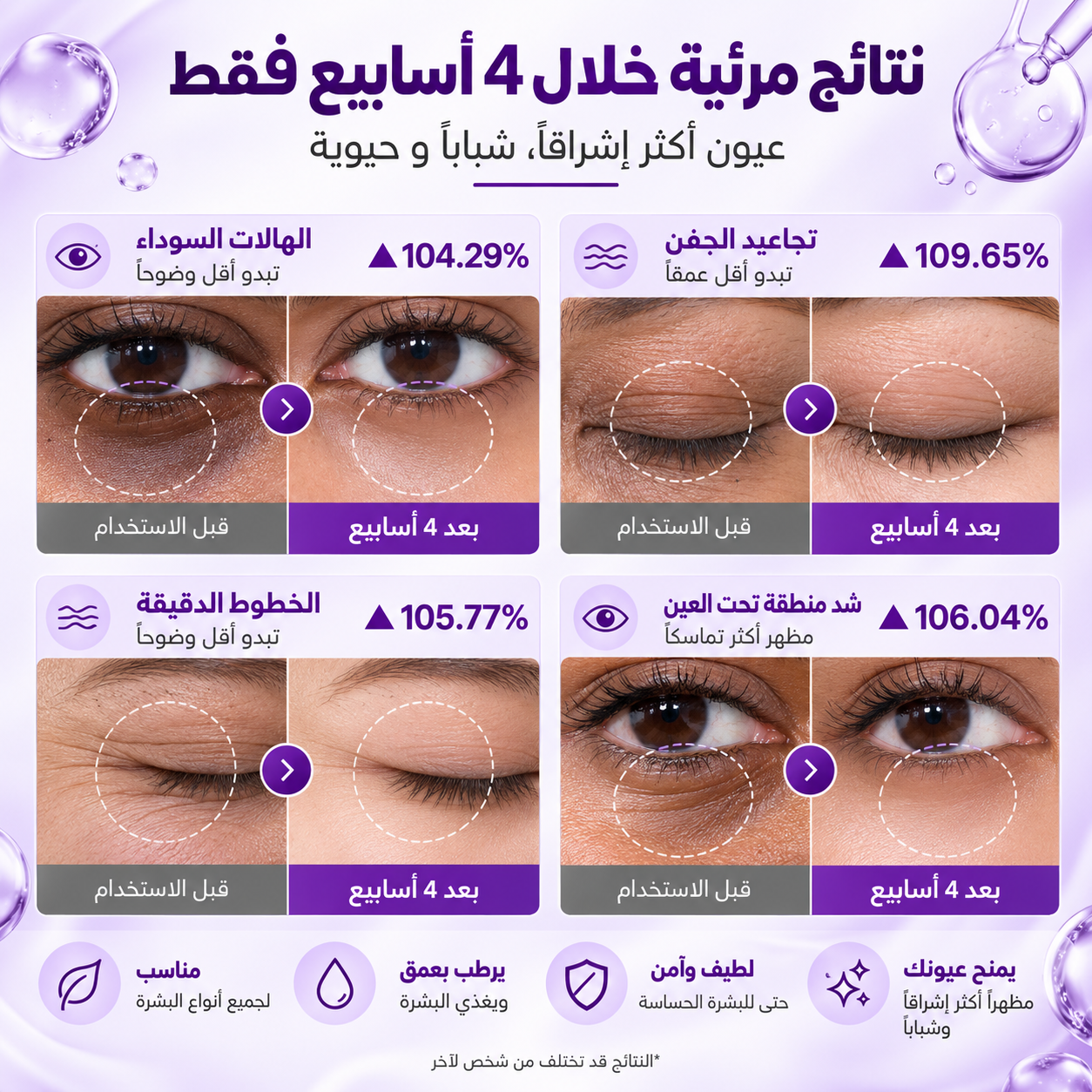 نتائج كريم العين على الهالات والتجاعيد خلال أربعة أسابيع